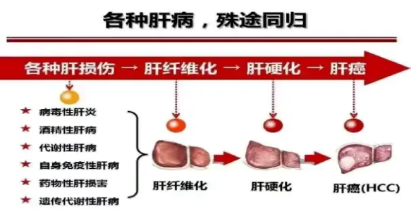 2024年世界肝炎日┃“肝”貨知識