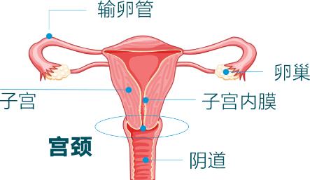 國際HPV知曉日| HPV早了解，宮頸癌早遠離